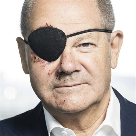 German Chancellor Scholz tweets picture of himself with black eye patch after jogging accident